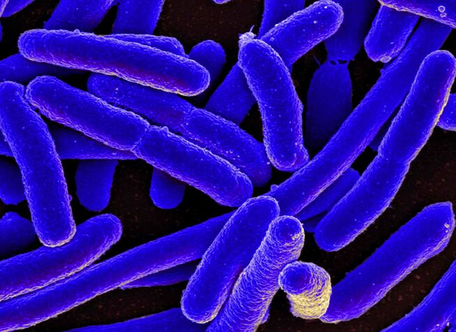 E. coli най-често провокира развитието на цистит при жените